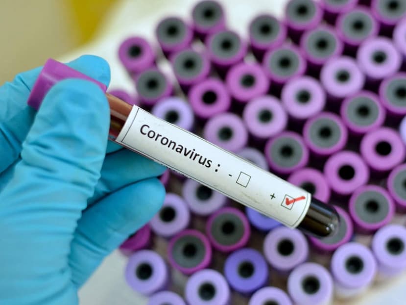 Что думают лидчане о коронавирусе?